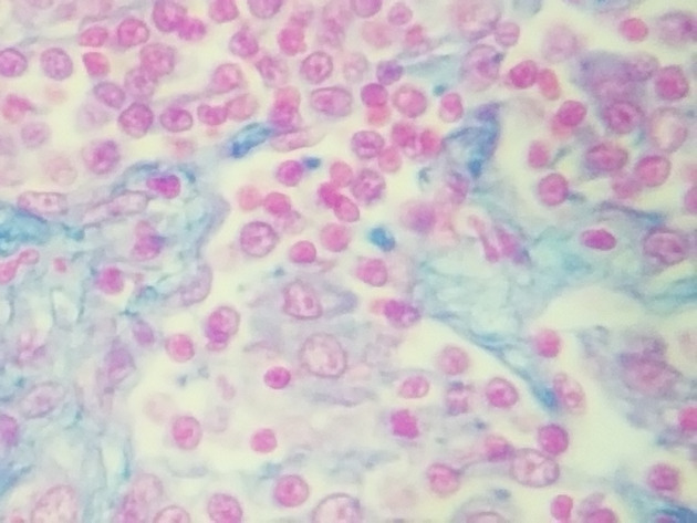Reticular Connective Slides - Reticular Connective 11 400X